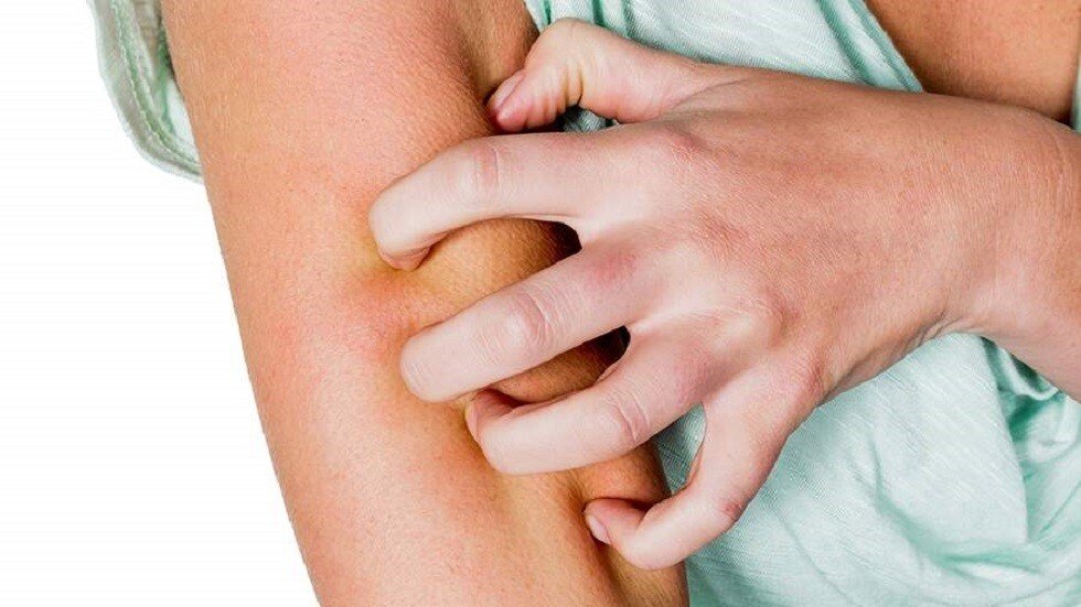 Understanding Winter Allergies and How to Manage Them